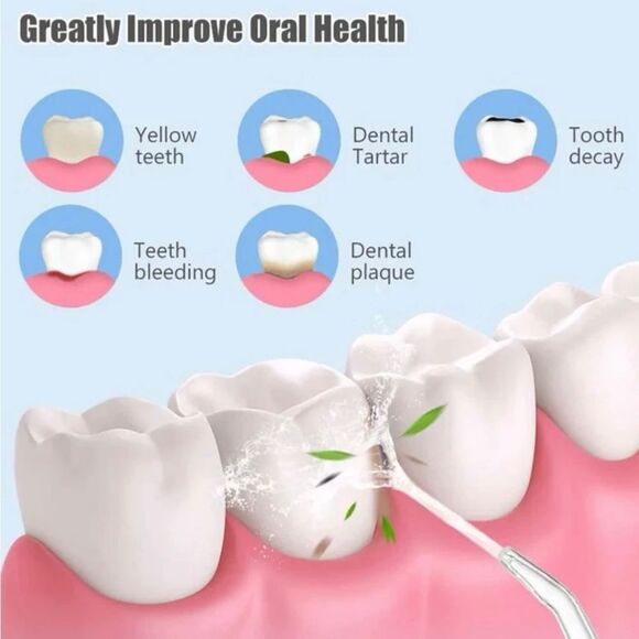 🆕Rechargeable Portable Handheld Cordless Water Flosser Oral Irrigator - Picture 4 of 7